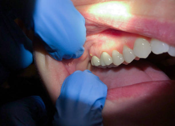 Best Emergency Cosmetic Dentistry in Centre Grove, NJ